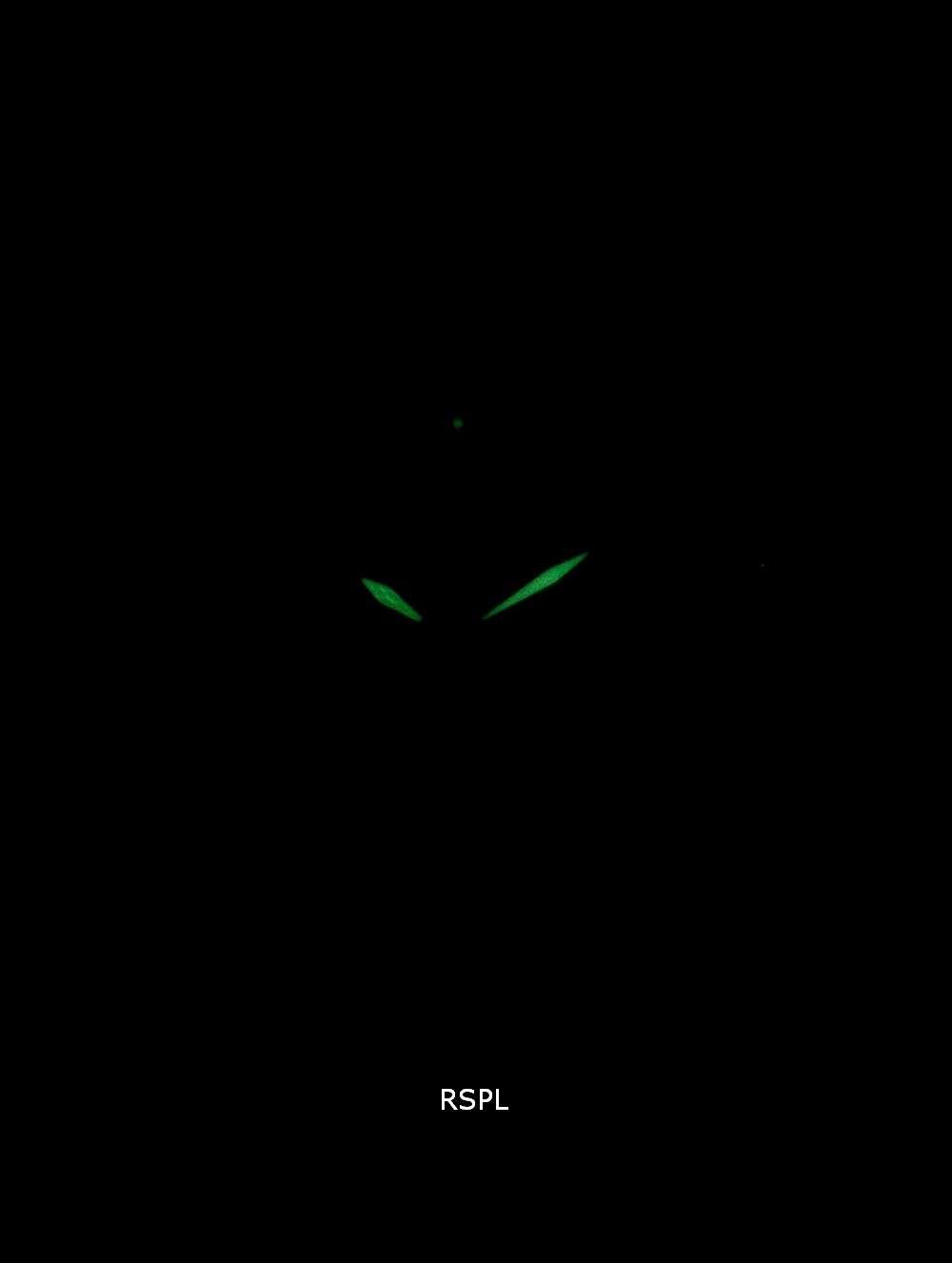 Seiko Classic SKK881P SKK881P1 SKK881 Diamond Accents Quartz Women's Watch