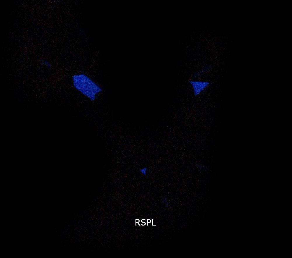 Invicta Coalition Forces 30381 Quartz Chronograph Men's Watch